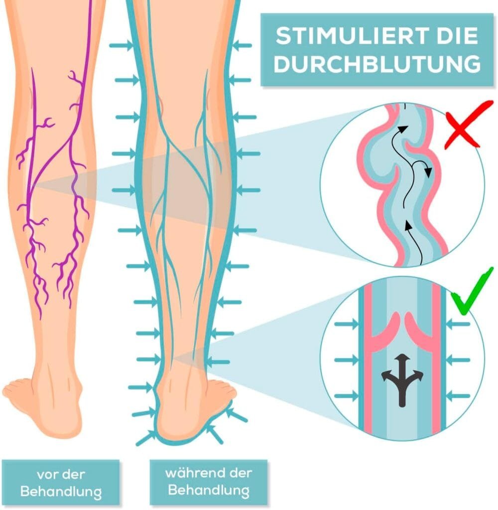 masajeador piernas con varices